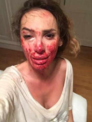 Nie żyje 35-letnia Ewelina Ślotała - autorka książek o kulisach życia w Konstancinie. Krzysztof Rutkowski udzielił jej pomocy po brutalnym pobiciu w Hiszpanii