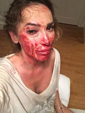 Nie żyje 35-letnia Ewelina Ślotała - autorka książek o kulisach życia w Konstancinie. Krzysztof Rutkowski udzielił jej pomocy po brutalnym pobiciu w Hiszpanii